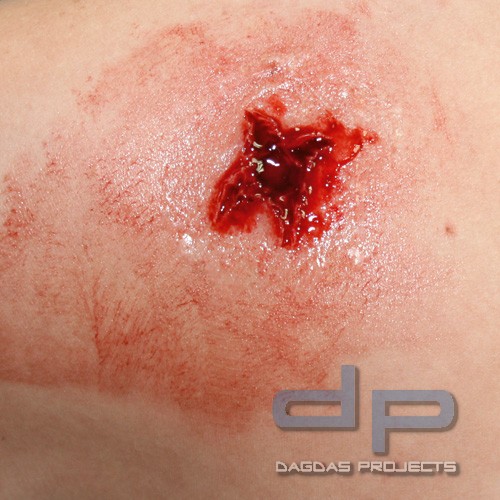 EZ Wounds Wundensimulationsset Professional Set mit 13 Wunden und Verbrauchsmaterial