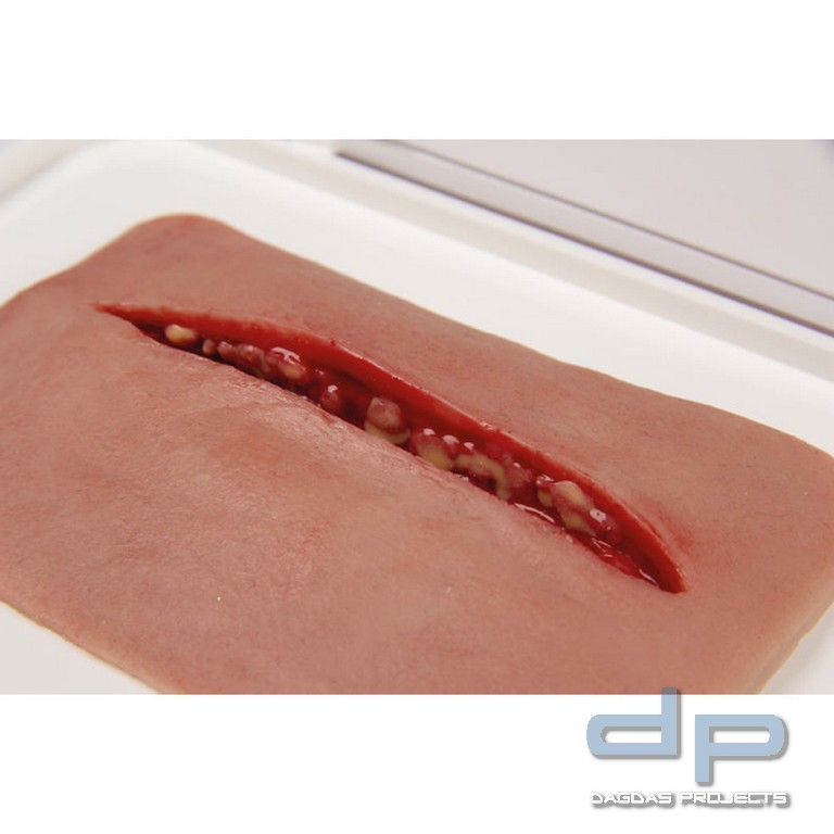 Wundmoulage Schnittwunde