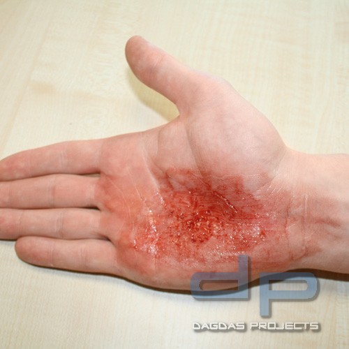 EZ Wounds Wundensimulationsset Basic Set mit 4 Wunden und Verbrauchsmaterial
