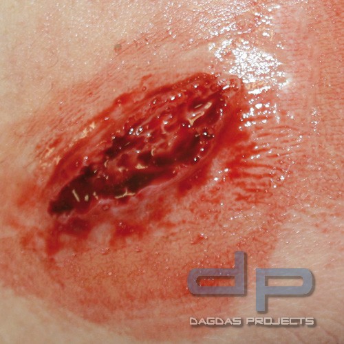 EZ Wounds Wundensimulationsset Basic Set mit 4 Wunden und Verbrauchsmaterial