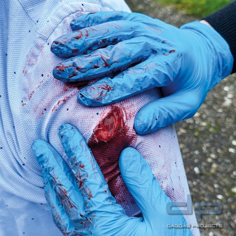 Wundmoulage Standard Set, selbsthaftend, inkl Aufbewahrungsbox