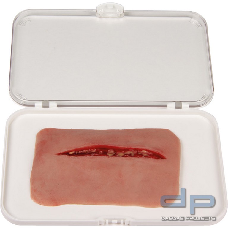 Wundmoulage Schnittwunde