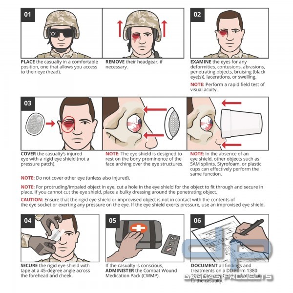 RHINO RESCUE EYE SHIELD AUGENSCHUTZ