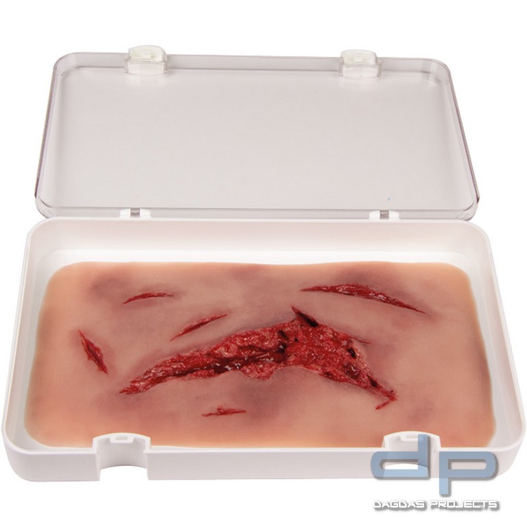 Wundmoulage Risswunde groß mit Blutungsfunktion