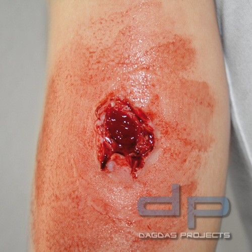 EZ Wounds Wundensimulationsset Basic Set mit 4 Wunden und Verbrauchsmaterial